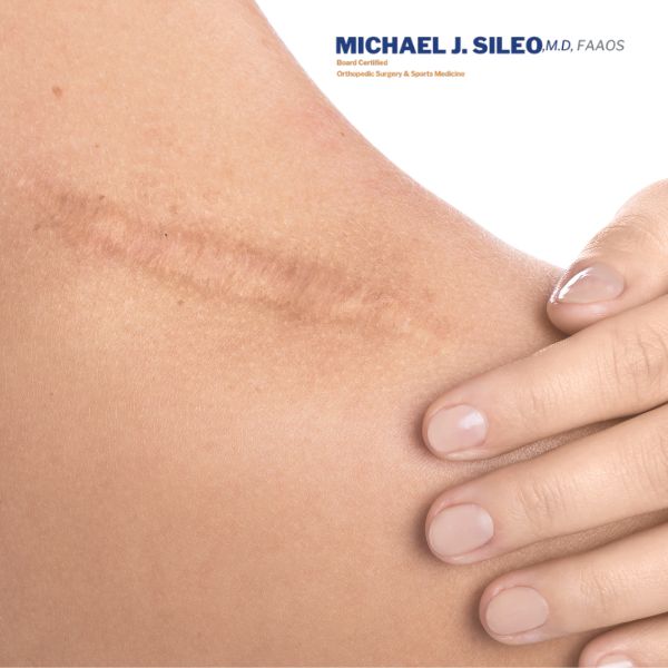 shoulder surgeon in centereach 1 Shoulder surgeon in centereach