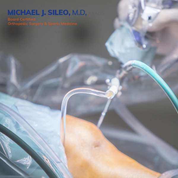 commack orthopedic surgeons dr michael sileo (1) A close up of a knee surgery in progress by Commack Orthopedic Surgeons, showing surgical instruments and the patient's knee under a transparent sterile drape